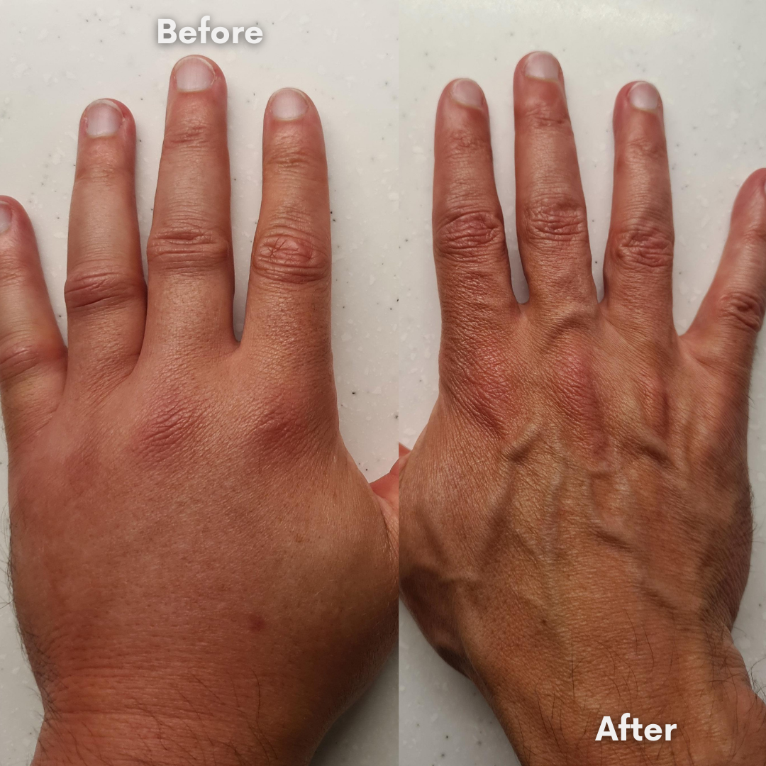 Reviva Lotion Bundle